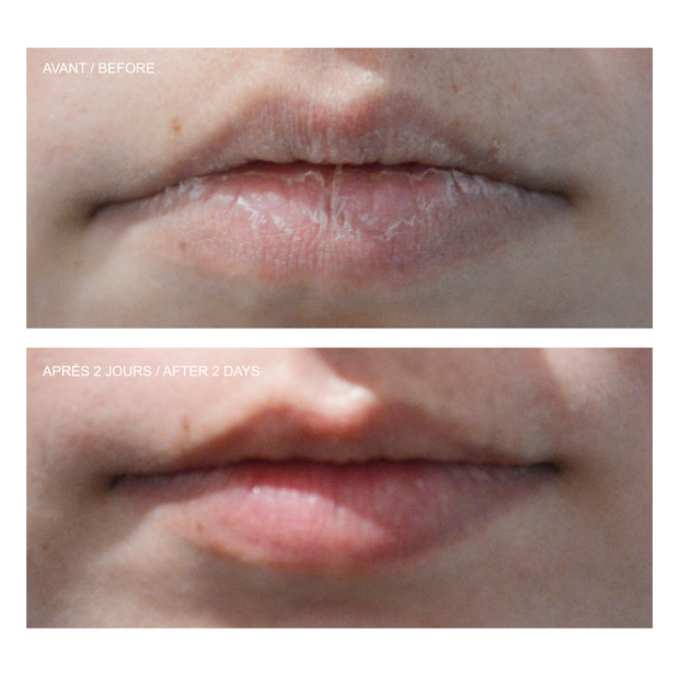 Lip Relief Balm