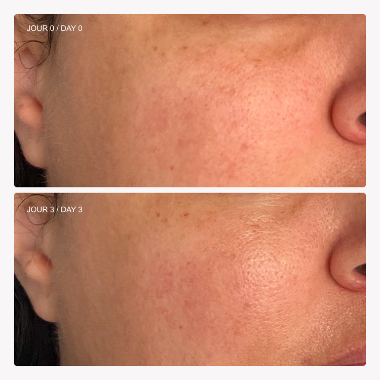 Express Revitalizing Mask Instant-Lift – Omy Laboratoires