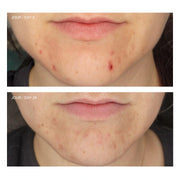 Gel nettoyant purifiant