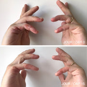 Photos avant-après de deux mains avec eczéma et une autre photo des mains avec moins d'eczéma suite à l'utilisation de la crème à mains Omy