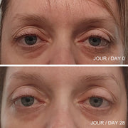 Images des résultat avant et après d'une femme adulte sur les poches et les rides sous ses yeux suite à l'utilisation de la crème contour des yeux multi-action.