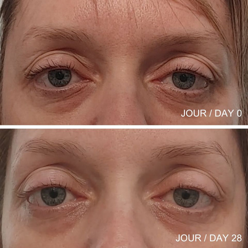 Images des résultat avant et après d'une femme adulte sur les poches et les rides sous ses yeux suite à l'utilisation de la crème contour des yeux multi-action.