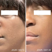 Image du visage d'une femme et de sa peau présentant des imperfections et un manque d'éclat, et une photo du résultat après l'utilisation de l'Huile Pure d'Omy Laboratoires.